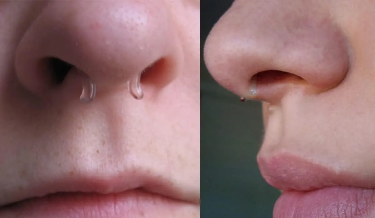 MODRSA 18g-20g Septum Rings & Studs - Clear Plastic Septum Retainer, Daith & Hoop Ear Plugs for Work/Surgery - Plastic, Helix, Tragus, Lip Piercing Retainers